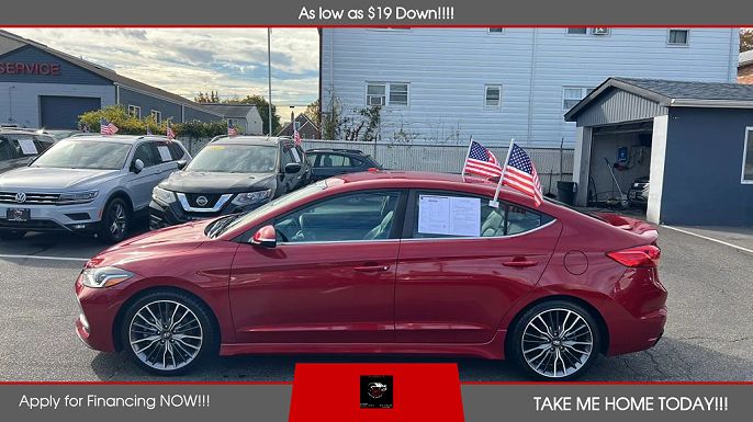 2017 Hyundai Elantra